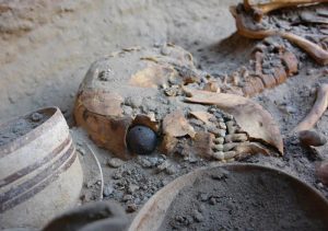 اولین چشم مصنوعی جهان